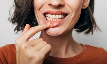 Woman pulling down lip showing gum disease in West Loop Chicago
